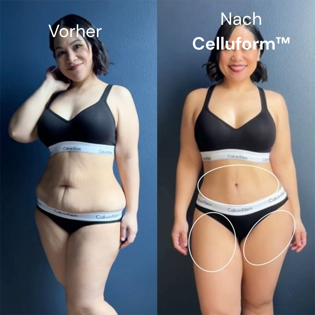 Celluform™