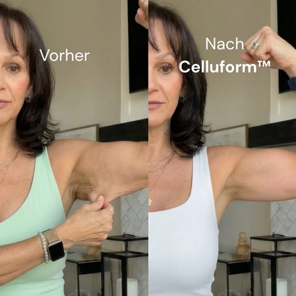 Celluform™